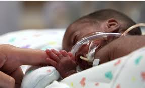 Murat Yetkin: New Details on the Neonatal Operation- A Flawed Health System Exposed